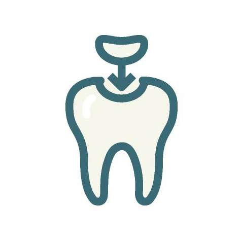 composite dental bonding