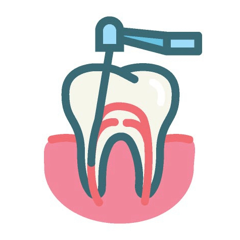 root canals
